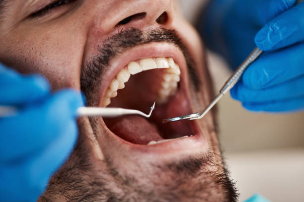 Best Emergency Denture Repair in Bowling Green, FL
