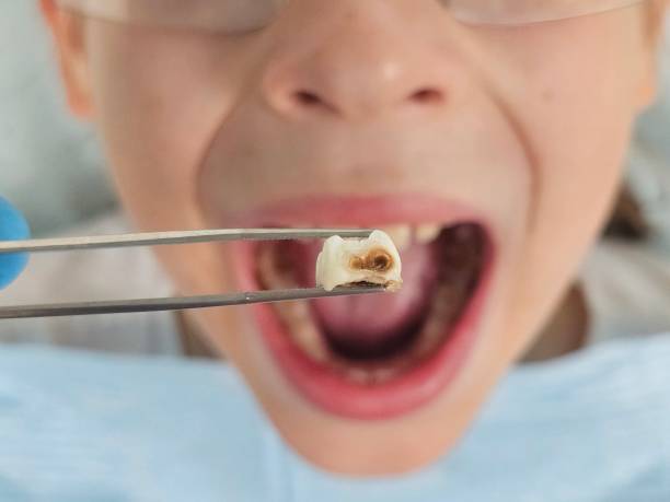Best Weekend Emergency Dental Services in Bowling Green, FL